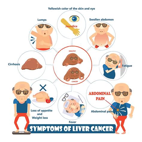 Liver Cancer: Signs, Symptoms, and Complications.